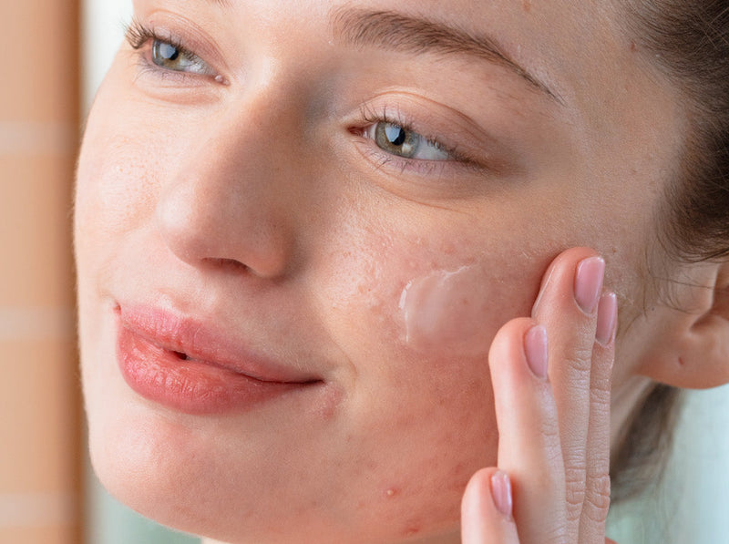 Effet rebond de l'acné après le soleil : pourquoi et comment agir ?